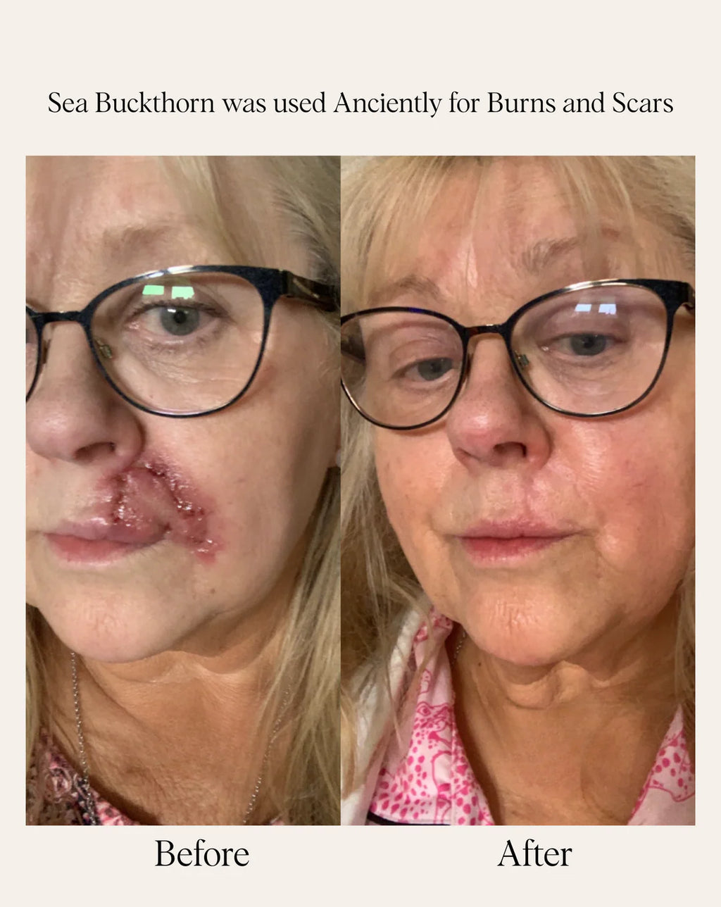 SEA BUCKTHORN SERUM