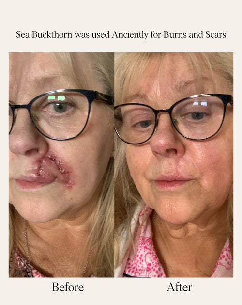 SEA BUCKTHORN SERUM